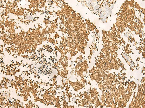 EFTUD2 Polyclonal Antibody - image 1