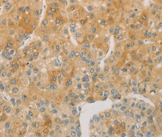 ACSL4 Polyclonal Antibody - image 1