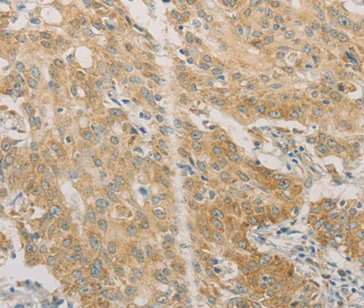 ACSL4 Polyclonal Antibody - image 2