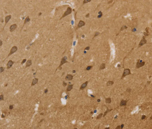 KCNN4 Polyclonal Antibody - image 1