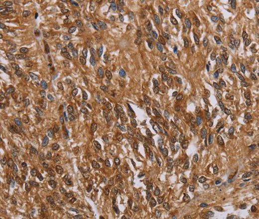 KARS Polyclonal Antibody - image 1