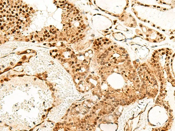 PDCD4 Polyclonal Antibody - image 1