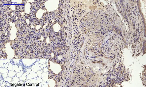 BMP2 Polyclonal Antibody - image 1