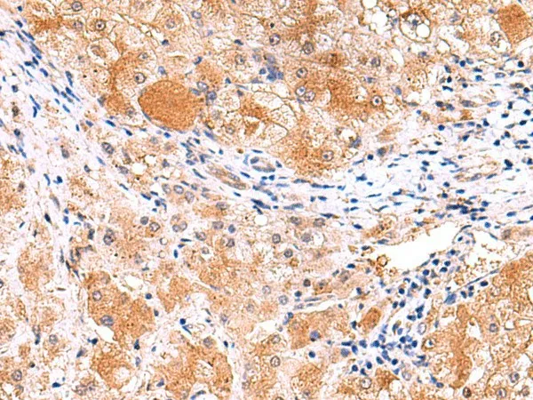 ITSN2 Polyclonal Antibody - image 1