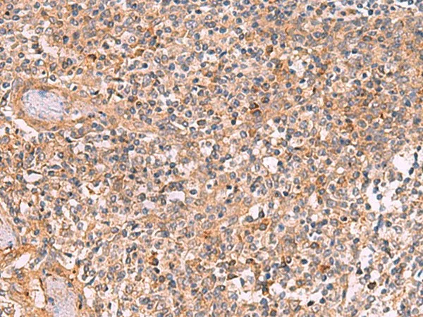 CREBBP Polyclonal Antibody - image 1