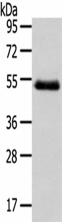NR2F2 Polyclonal Antibody - image 1