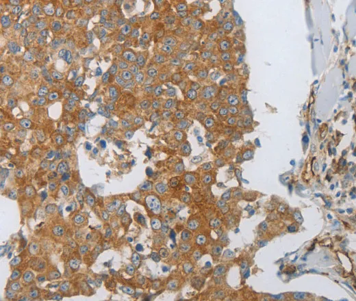 CD31 Polyclonal Antibody - image 1