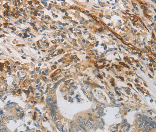 CD31 Polyclonal Antibody - image 2