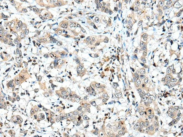 SPCS2 Polyclonal Antibody - image 2