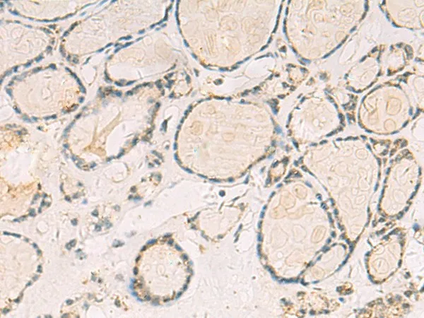 TCAP Polyclonal Antibody - image 1
