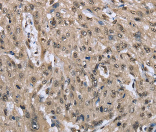 DYNLL1 Polyclonal Antibody - image 1