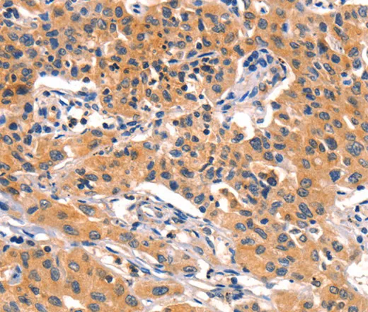 AMY2A Polyclonal Antibody - image 1