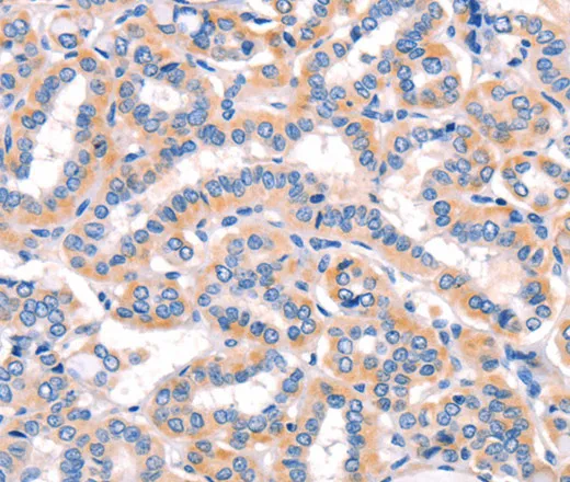 AMY2A Polyclonal Antibody - image 2