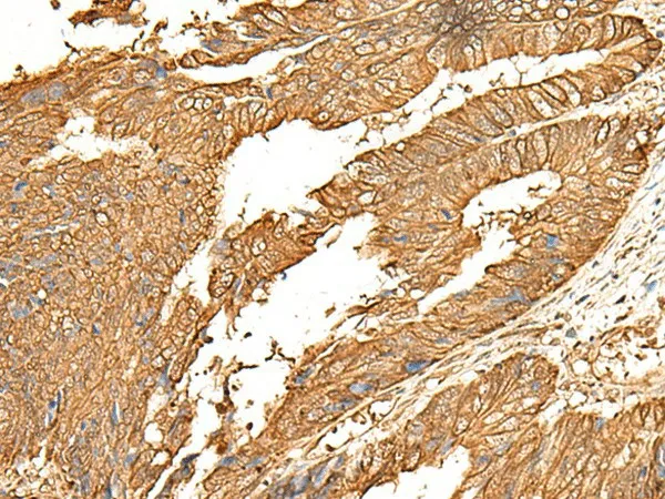 P2RY14 Polyclonal Antibody - image 1