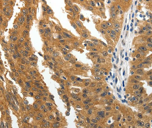 BIRC6 Polyclonal Antibody - image 1