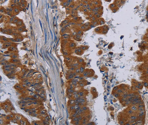 NECTIN3 Polyclonal Antibody - image 1