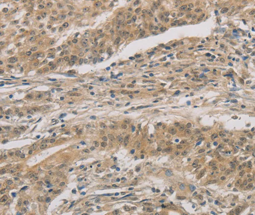 DDIT4 Polyclonal Antibody - image 1