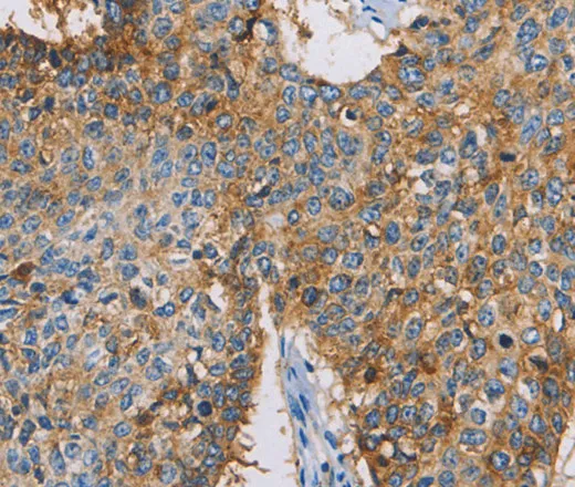 CDCP1 Polyclonal Antibody - image 1