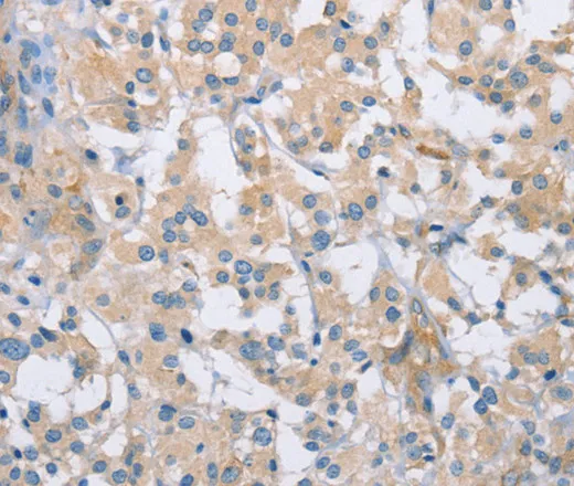 CDCP1 Polyclonal Antibody - image 2