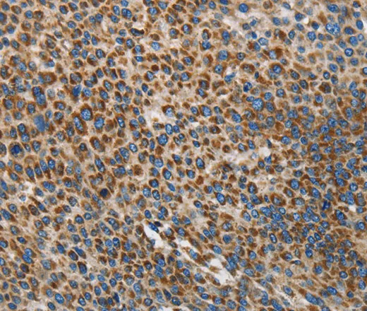 UPF1 Polyclonal Antibody - image 1