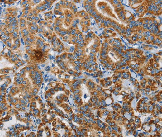 UPF1 Polyclonal Antibody - image 2