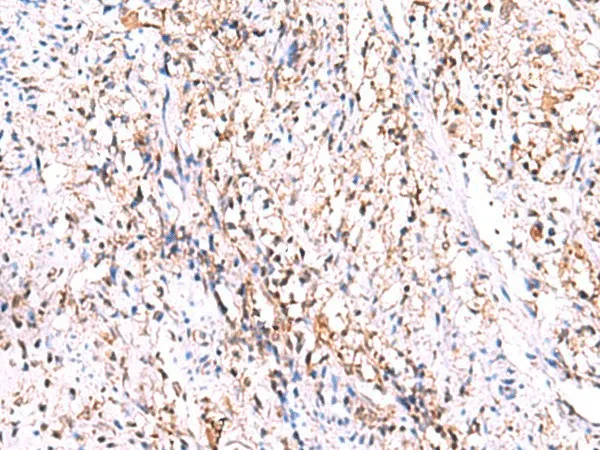 GMDS Polyclonal Antibody - image 1
