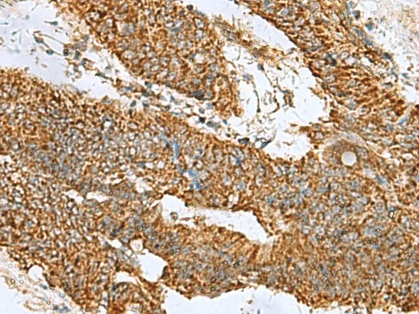 PREPL Polyclonal Antibody - image 1