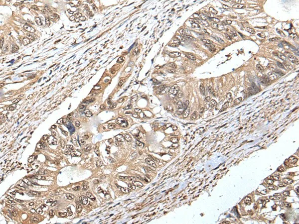 ATF6B Polyclonal Antibody - image 1
