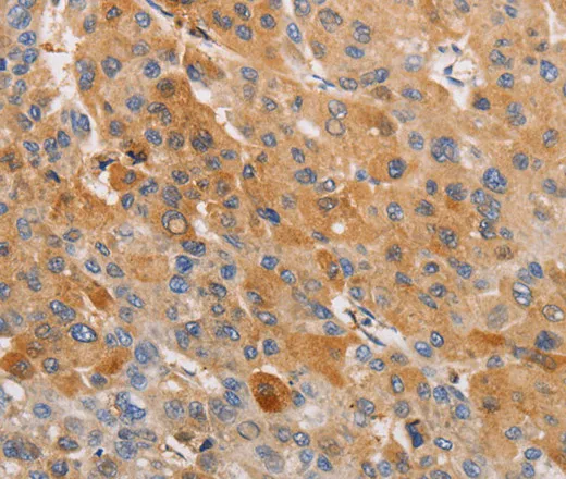OLR1 Polyclonal Antibody - image 1
