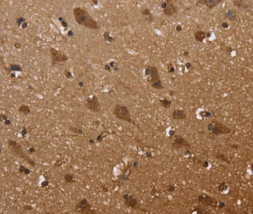 FANCF Polyclonal Antibody - image 1