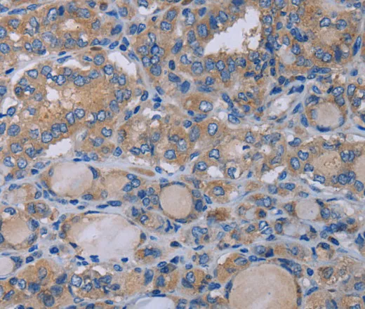 P2RX3 Polyclonal Antibody - image 1