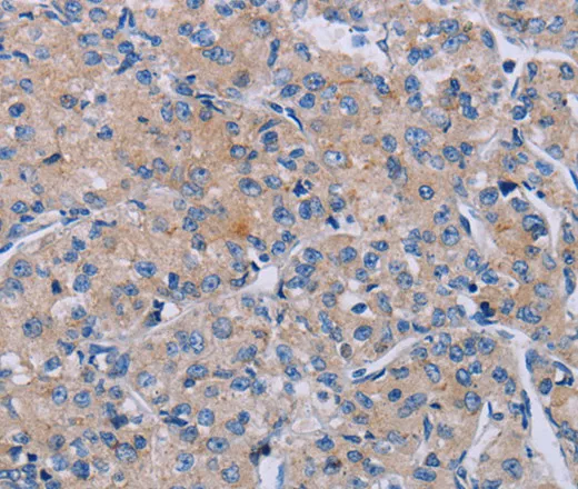 P2RX3 Polyclonal Antibody - image 2