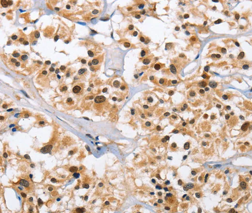 NCAPD3 Polyclonal Antibody - image 1