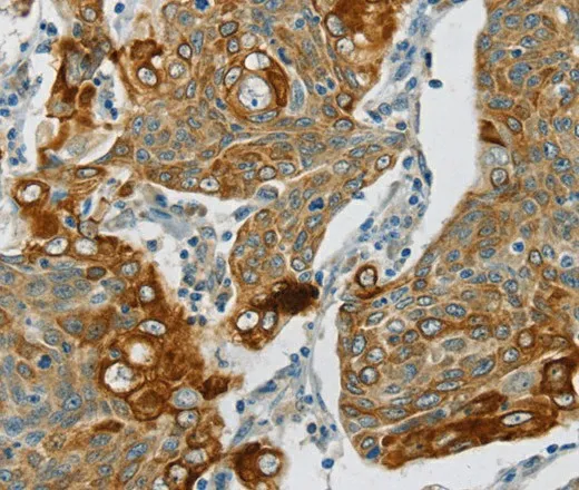SMOC2 Polyclonal Antibody - image 1