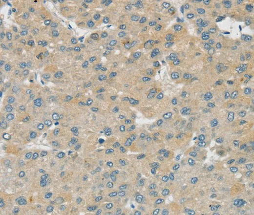 SMOC2 Polyclonal Antibody - image 2
