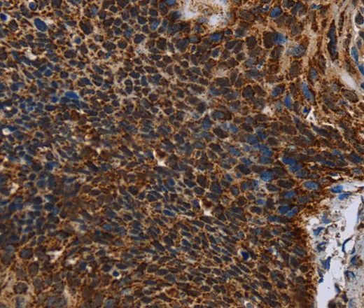 IDH2 Polyclonal Antibody - image 1