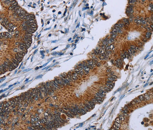 IDH2 Polyclonal Antibody - image 2