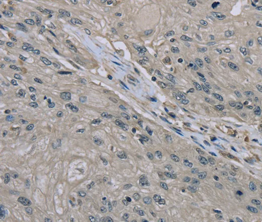 EDN1 Polyclonal Antibody - image 1