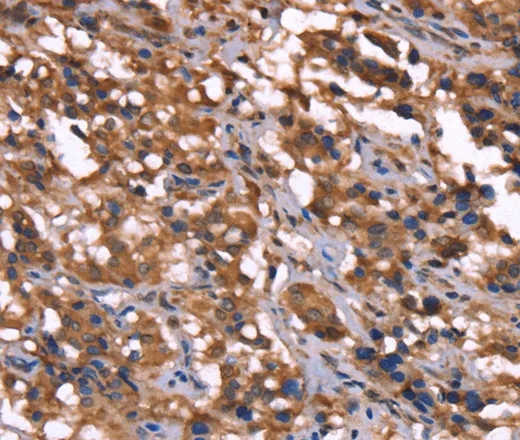 GREB1 Polyclonal Antibody - image 1