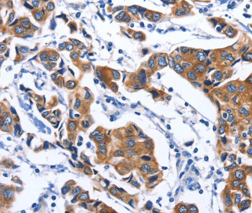 MYH1 Polyclonal Antibody - image 1