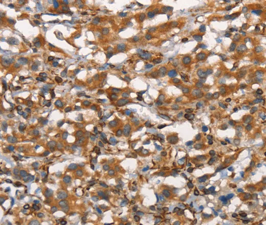CDC23 Polyclonal Antibody - image 1