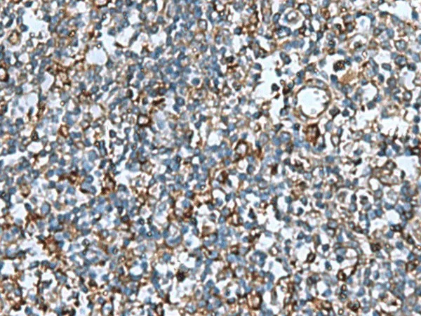 COMMD9 Polyclonal Antibody - image 1