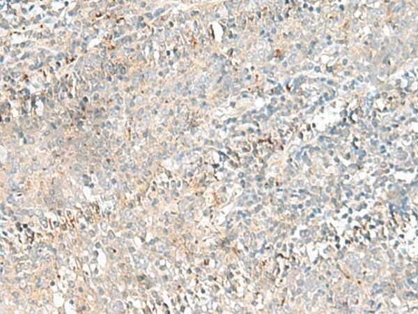 CTRB1 Polyclonal Antibody - image 1