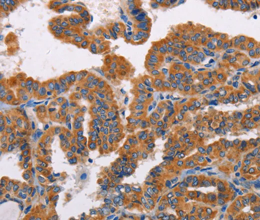 ALG9 Polyclonal Antibody - image 1