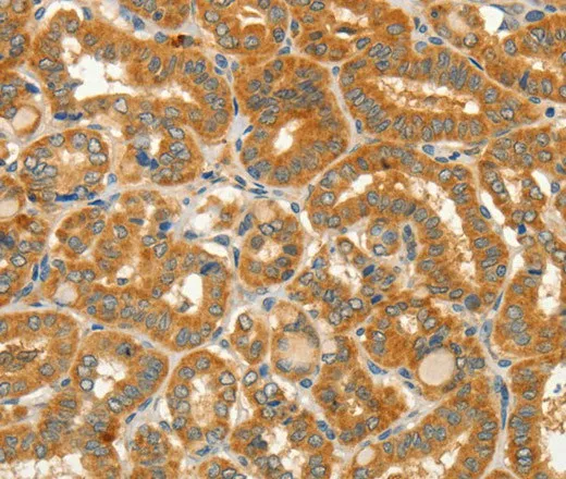CIB1 Polyclonal Antibody - image 1