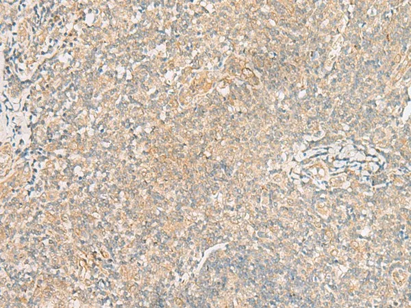 TRAF6 Polyclonal Antibody - image 1