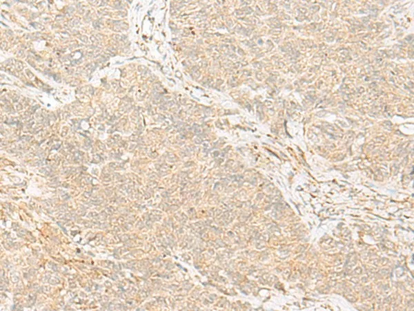 TRAF6 Polyclonal Antibody - image 2