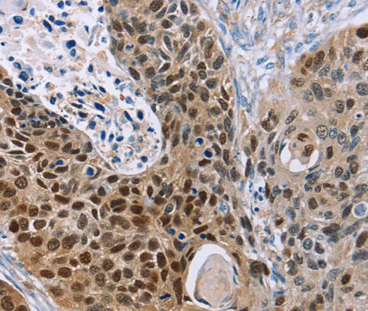 MAGEA10 Polyclonal Antibody - image 1