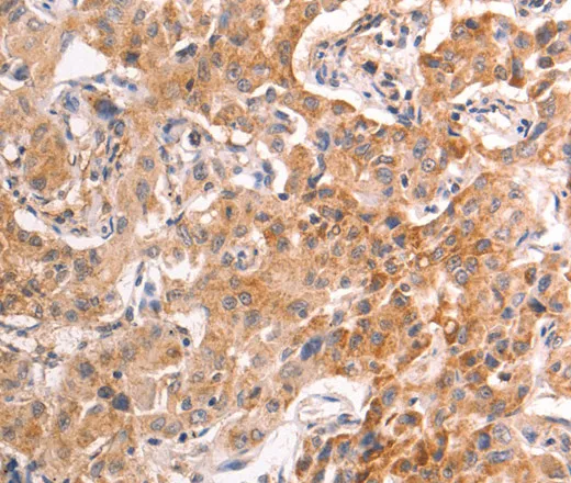 TRPV4 Polyclonal Antibody - image 1