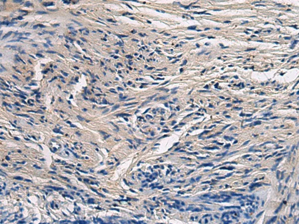 CYTIP Polyclonal Antibody - image 1
